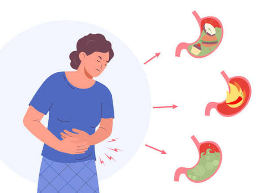 Best Doctor for Bloating Blood in Stools Constipation Burps in Parel