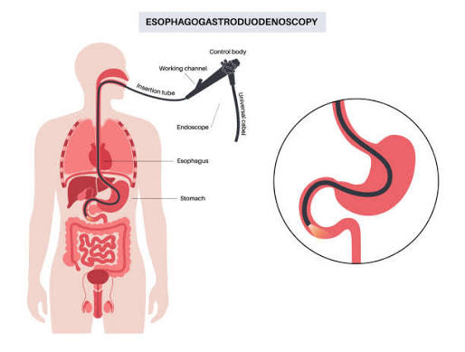 Best Doctor for Gastroscopy in Parel